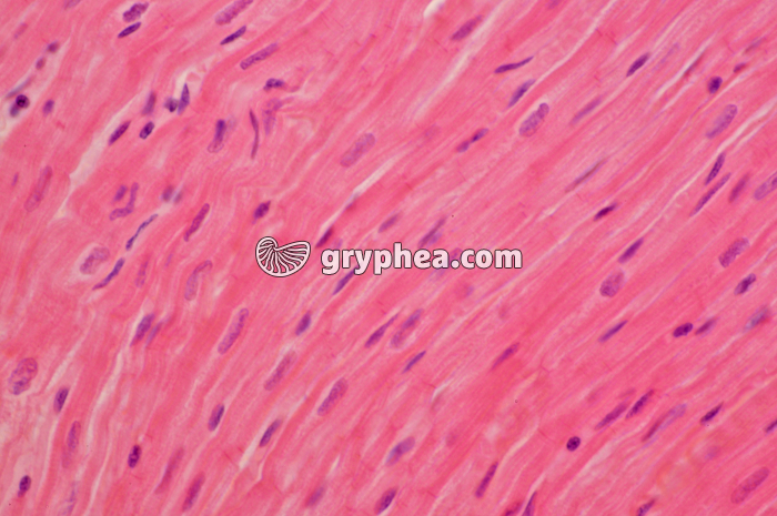 Mucle cardiaque CL x160 - gryphea.com